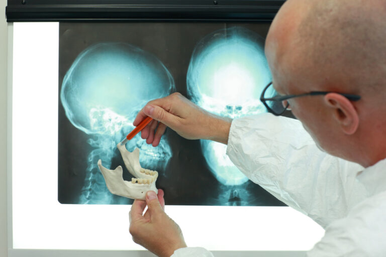 Professional treatment planning with model of lower jaw watching x-ray