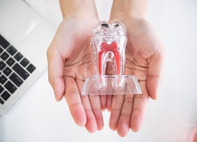 Dentist holding transparent crystal artificial red root tooth model